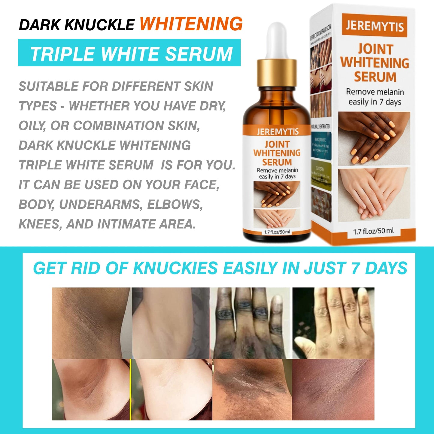 ⏰[Official Brand Store 24-Hours Promotion Buy 1 Get 2 Free] JEREMYTIS™ Joint Whitening Serum