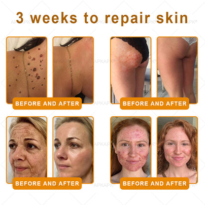 Made and Shipped from USA 🌞 𝖡𝖾𝖾 𝗏𝖾𝗇𝗈𝗆 𝖲𝗄𝗂𝗇 𝖱𝖾𝗌𝗍𝗈𝗋𝖺𝗍𝗂𝗈𝗇 𝖢𝗋𝖾𝖺𝗆