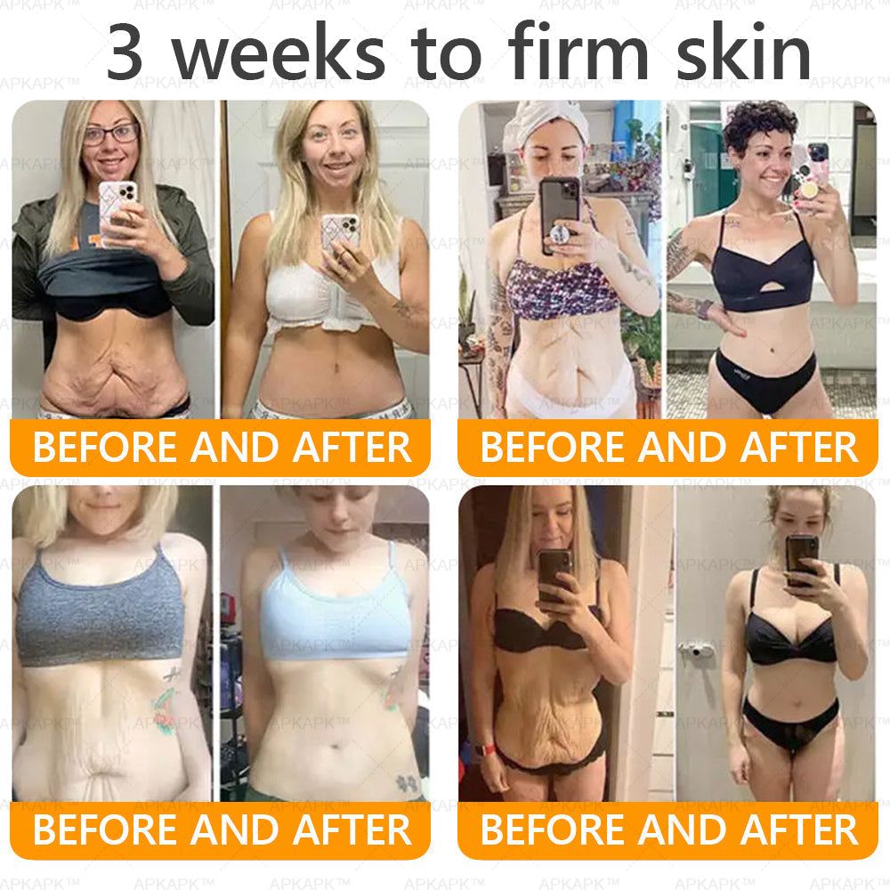 Made and Shipped from USA 🌞 𝖡𝖾𝖾 𝗏𝖾𝗇𝗈𝗆 𝖲𝗄𝗂𝗇 𝖱𝖾𝗌𝗍𝗈𝗋𝖺𝗍𝗂𝗈𝗇 𝖢𝗋𝖾𝖺𝗆