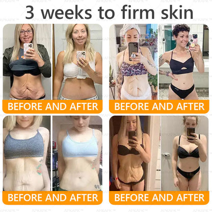 Made and Shipped from USA 🌞 𝖡𝖾𝖾 𝗏𝖾𝗇𝗈𝗆 𝖲𝗄𝗂𝗇 𝖱𝖾𝗌𝗍𝗈𝗋𝖺𝗍𝗂𝗈𝗇 𝖢𝗋𝖾𝖺𝗆