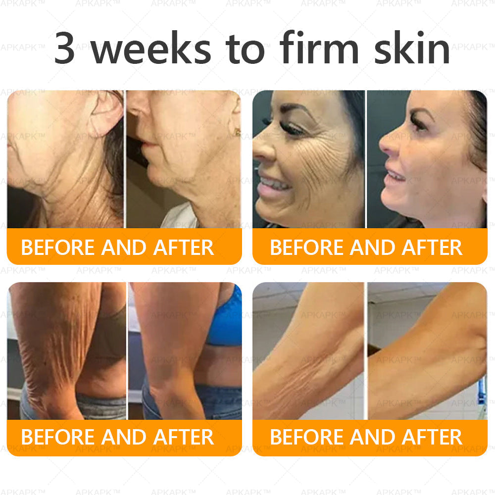 Made and Shipped from USA 🌞 𝖡𝖾𝖾 𝗏𝖾𝗇𝗈𝗆 𝖲𝗄𝗂𝗇 𝖱𝖾𝗌𝗍𝗈𝗋𝖺𝗍𝗂𝗈𝗇 𝖢𝗋𝖾𝖺𝗆