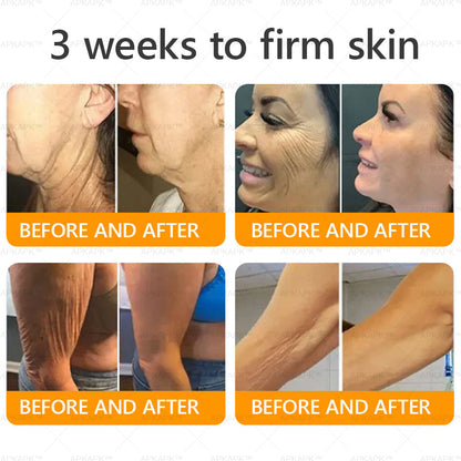 Made and Shipped from USA 🌞 𝖡𝖾𝖾 𝗏𝖾𝗇𝗈𝗆 𝖲𝗄𝗂𝗇 𝖱𝖾𝗌𝗍𝗈𝗋𝖺𝗍𝗂𝗈𝗇 𝖢𝗋𝖾𝖺𝗆