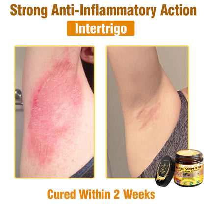 ZAKDAVI™ Bee Venom All-in-One Cream US Dermatologist Approved-