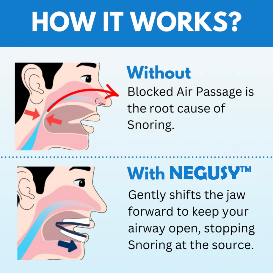 NEGUSY™ Silent Sleep Mouthpiece