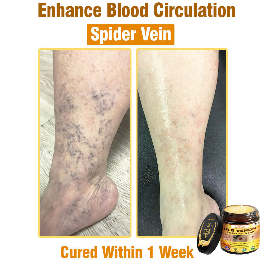 ZAKDAVI™ Bee Venom All-in-One Cream US Dermatologist Approved-