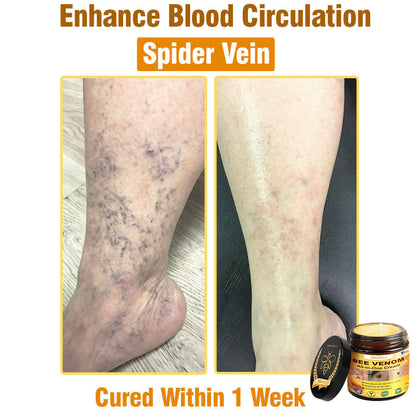 ZAKDAVI™ Bee Venom All-in-One Cream US Dermatologist Approved-