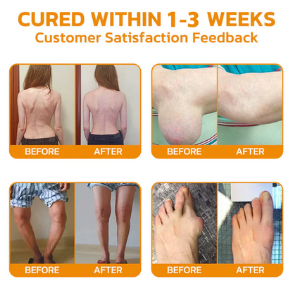 🎁✅Official Store BUY 2 GET 1 FREE: flysmus™ Lidocaine Scar-Free Pain Relief Healing Liquid👨‍⚕️USA Osteopathic Medical Association （AAOS）Approved(Reducing joint swelling, pain, stiffness, redness, warmth, soreness and joint fatigue )