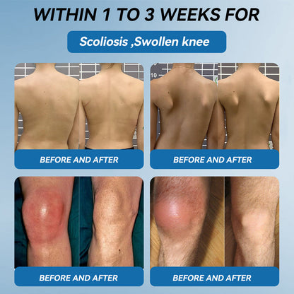 💪𝐎𝐟𝐟𝐢𝐜𝐢𝐚𝐥 𝐬𝐭𝐨𝐫𝐞 |𝑩𝐏𝐂-𝟏𝟓𝟕 𝐉𝐨𝐢𝐧𝐭 𝐇𝐞𝐚𝐥𝐢𝐧𝐠 𝐂𝐫𝐞𝐚𝐦🦴𝐓𝐫𝐞𝐚𝐭𝐬 𝐀𝐫𝐭𝐡𝐫𝐢𝐭𝐢𝐬, 𝐍𝐞𝐮𝐫𝐨𝐩𝐚𝐭𝐡𝐲, 𝐑𝐡𝐞𝐮𝐦𝐚𝐭𝐢𝐬𝐦, 𝐒𝐩𝐨𝐫𝐭𝐬 𝐈𝐧𝐣𝐮𝐫𝐢𝐞𝐬 & 𝐌𝐨𝐫𝐞 💪