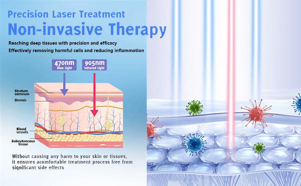 🔥(Official Mall)🔥NESLEMY Nail Fungus cleaning Light Device-🗽Made and Shipped from USA 🔥