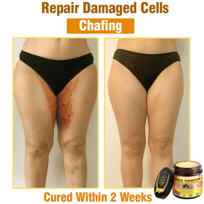 ZAKDAVI™ Bee Venom All-in-One Cream US Dermatologist Approved-