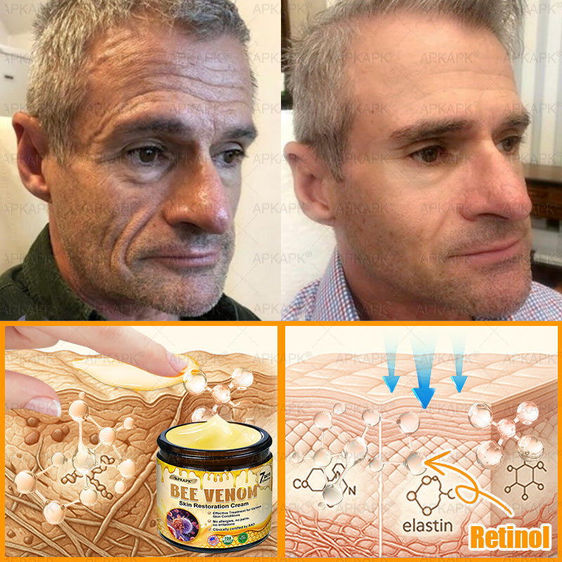 Made and Shipped from USA 🌞 𝖡𝖾𝖾 𝗏𝖾𝗇𝗈𝗆 𝖲𝗄𝗂𝗇 𝖱𝖾𝗌𝗍𝗈𝗋𝖺𝗍𝗂𝗈𝗇 𝖢𝗋𝖾𝖺𝗆