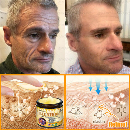 Made and Shipped from USA 🌞 𝖡𝖾𝖾 𝗏𝖾𝗇𝗈𝗆 𝖲𝗄𝗂𝗇 𝖱𝖾𝗌𝗍𝗈𝗋𝖺𝗍𝗂𝗈𝗇 𝖢𝗋𝖾𝖺𝗆