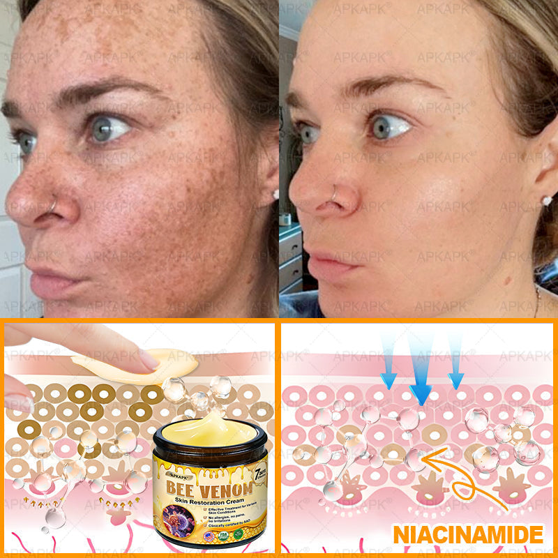 Made and Shipped from USA 🌞 𝖡𝖾𝖾 𝗏𝖾𝗇𝗈𝗆 𝖲𝗄𝗂𝗇 𝖱𝖾𝗌𝗍𝗈𝗋𝖺𝗍𝗂𝗈𝗇 𝖢𝗋𝖾𝖺𝗆