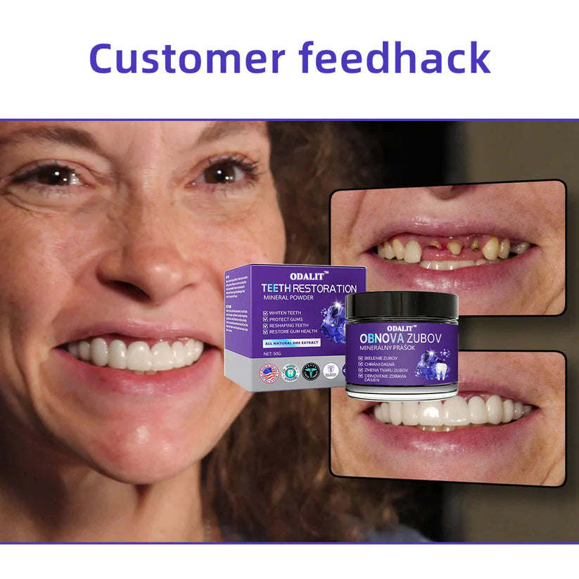 ODALIT™ TeethRestoration Mineral Powder🦷(ADA recommended) (🔥Flash Sale - Don’t Miss Out)