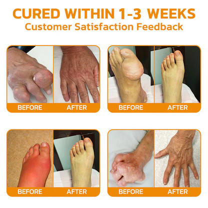 🎁✅Official Store BUY 2 GET 1 FREE: flysmus™ Lidocaine Scar-Free Pain Relief Healing Liquid👨‍⚕️USA Osteopathic Medical Association （AAOS）Approved(Reducing joint swelling, pain, stiffness, redness, warmth, soreness and joint fatigue )