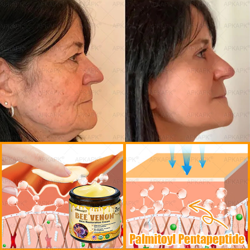 Made and Shipped from USA 🌞 𝖡𝖾𝖾 𝗏𝖾𝗇𝗈𝗆 𝖲𝗄𝗂𝗇 𝖱𝖾𝗌𝗍𝗈𝗋𝖺𝗍𝗂𝗈𝗇 𝖢𝗋𝖾𝖺𝗆