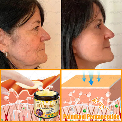 Made and Shipped from USA 🌞 𝖡𝖾𝖾 𝗏𝖾𝗇𝗈𝗆 𝖲𝗄𝗂𝗇 𝖱𝖾𝗌𝗍𝗈𝗋𝖺𝗍𝗂𝗈𝗇 𝖢𝗋𝖾𝖺𝗆