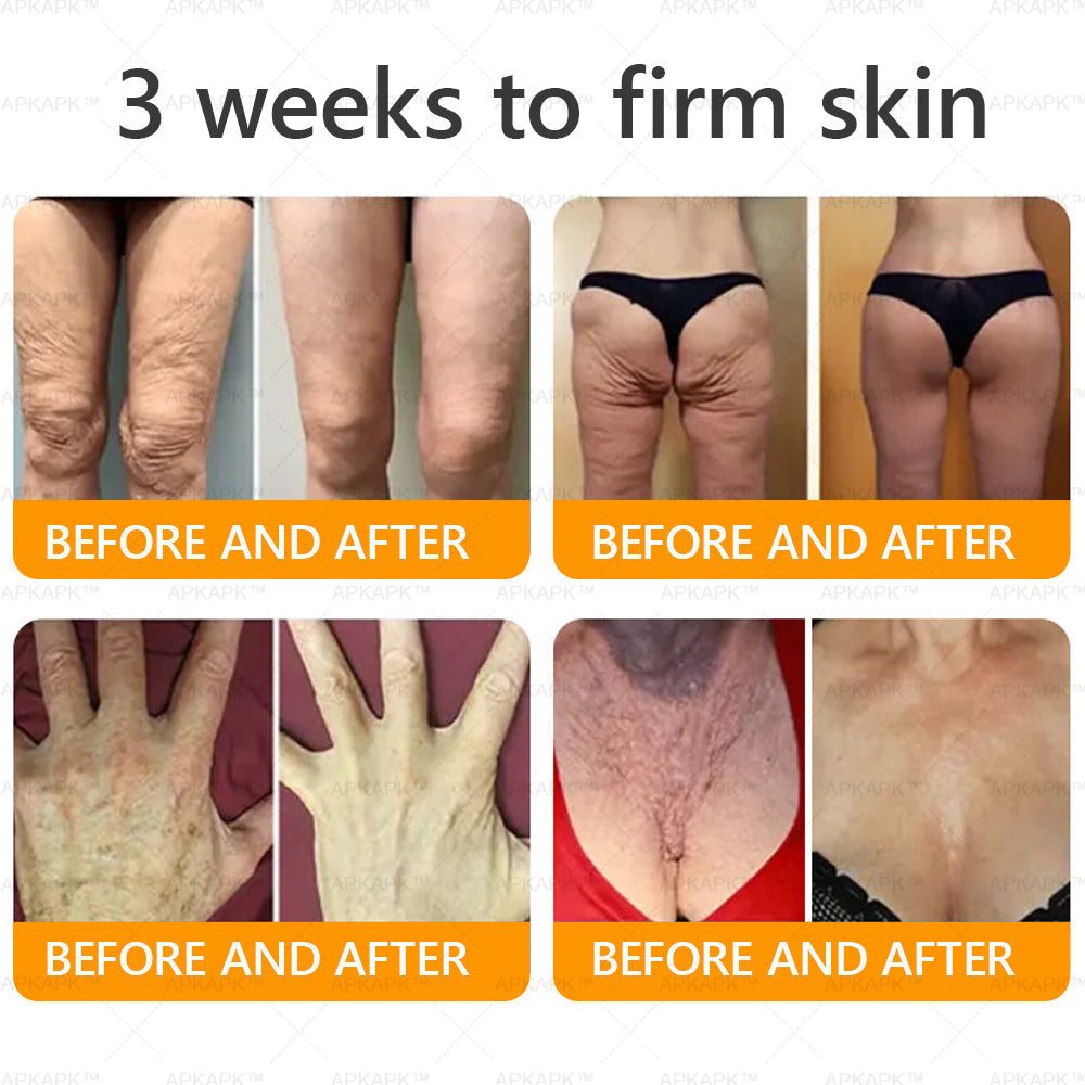 Made and Shipped from USA 🌞 𝖡𝖾𝖾 𝗏𝖾𝗇𝗈𝗆 𝖲𝗄𝗂𝗇 𝖱𝖾𝗌𝗍𝗈𝗋𝖺𝗍𝗂𝗈𝗇 𝖢𝗋𝖾𝖺𝗆