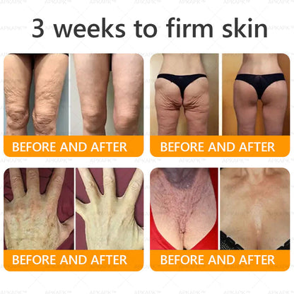 Made and Shipped from USA 🌞 𝖡𝖾𝖾 𝗏𝖾𝗇𝗈𝗆 𝖲𝗄𝗂𝗇 𝖱𝖾𝗌𝗍𝗈𝗋𝖺𝗍𝗂𝗈𝗇 𝖢𝗋𝖾𝖺𝗆