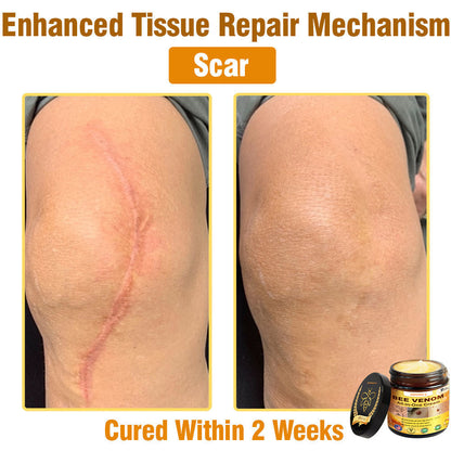 ZAKDAVI™ Bee Venom All-in-One Cream US Dermatologist Approved-