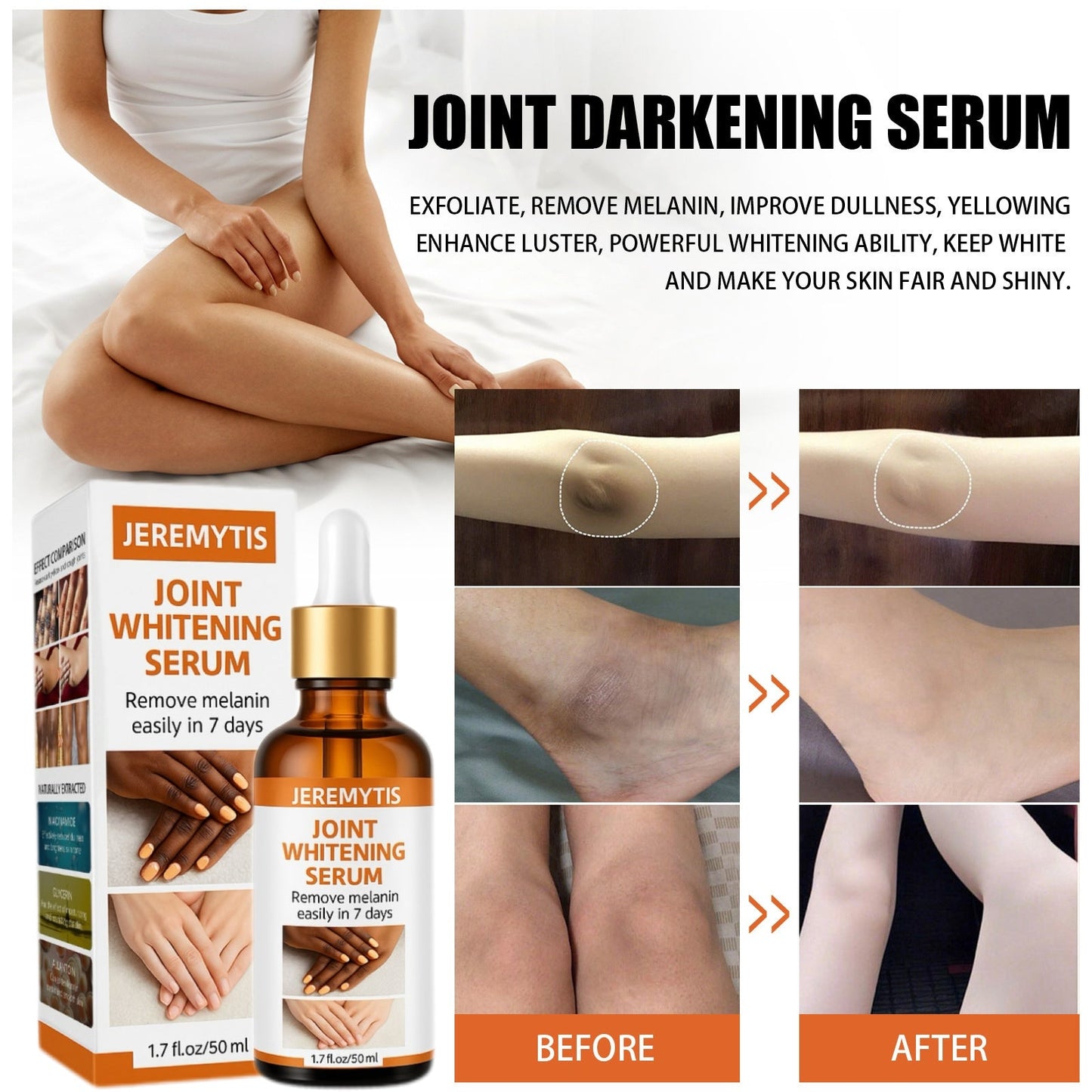 ⏰[Official Brand Store 24-Hours Promotion Buy 1 Get 2 Free] JEREMYTIS™ Joint Whitening Serum