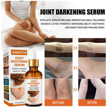 ⏰[Official Brand Store 24-Hours Promotion Buy 1 Get 2 Free] JEREMYTIS™ Joint Whitening Serum