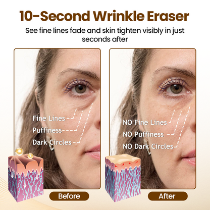 Liftora 10s Extreme Rapid Wrinkle Serum: 10-Second Visible Lift