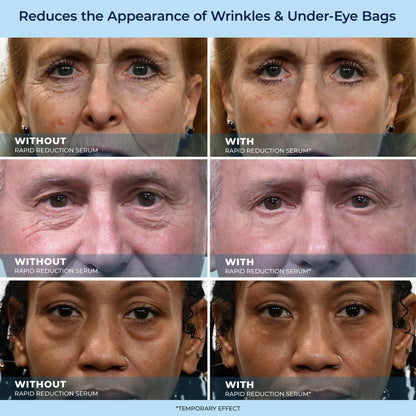 LBMLBM™ Rapid Reduction Wrinkle Serum