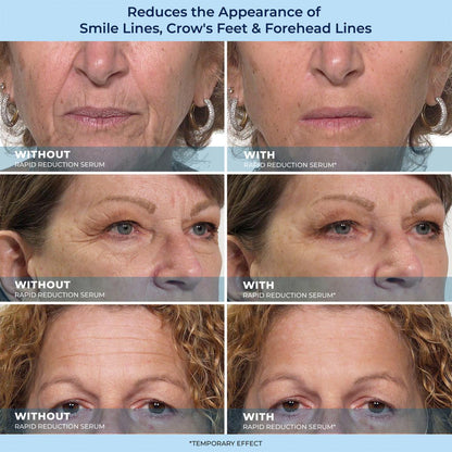 LBMLBM™ Rapid Reduction Wrinkle Serum
